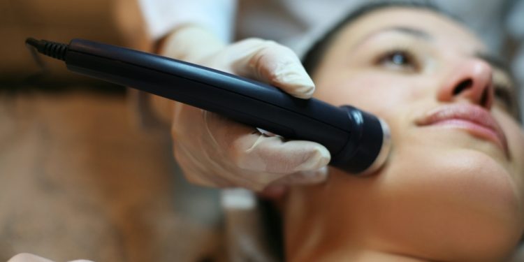 Do you have melasma